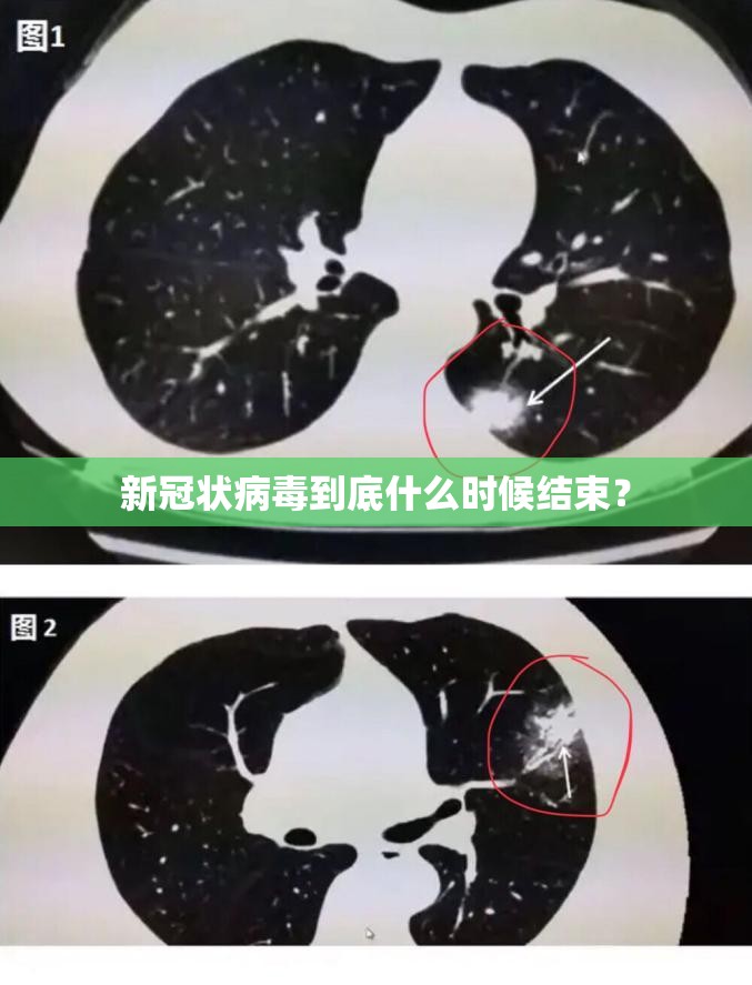新冠状病毒到底什么时候结束？