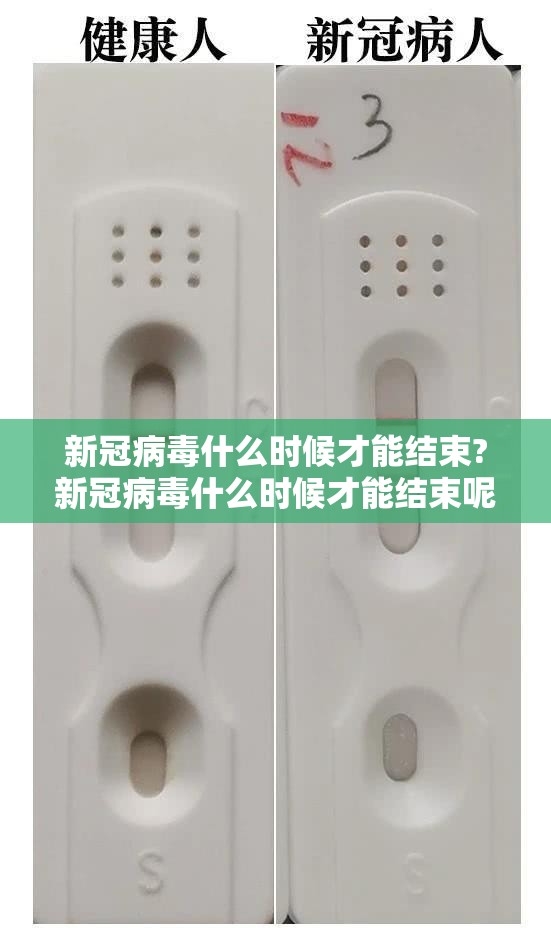 新冠病毒什么时候才能结束?新冠病毒什么时候才能结束呢