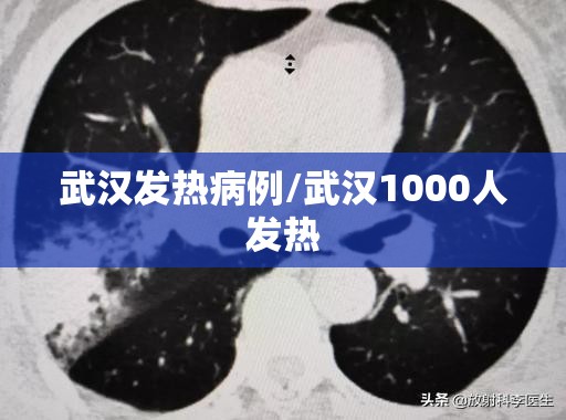 武汉发热病例/武汉1000人发热