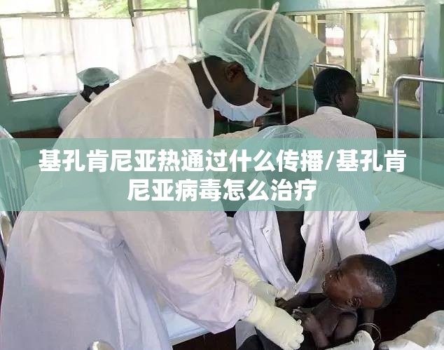 基孔肯尼亚热通过什么传播/基孔肯尼亚病毒怎么治疗