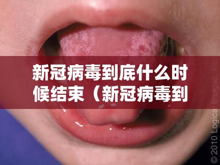 新冠病毒到底什么时候结束（新冠病毒到底什么时候结束的）
