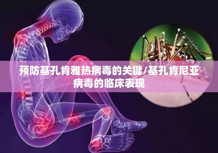 预防基孔肯雅热病毒的关键/基孔肯尼亚病毒的临床表现