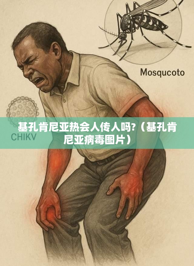 基孔肯尼亚热会人传人吗?（基孔肯尼亚病毒图片）