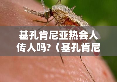 基孔肯尼亚热会人传人吗?（基孔肯尼亚病毒图片）