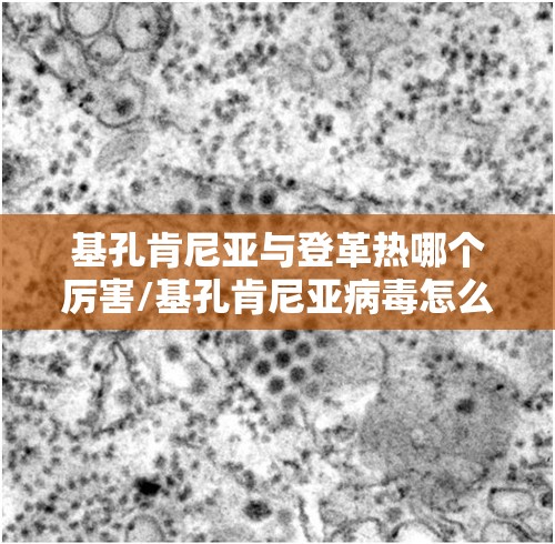 基孔肯尼亚与登革热哪个厉害/基孔肯尼亚病毒怎么治疗