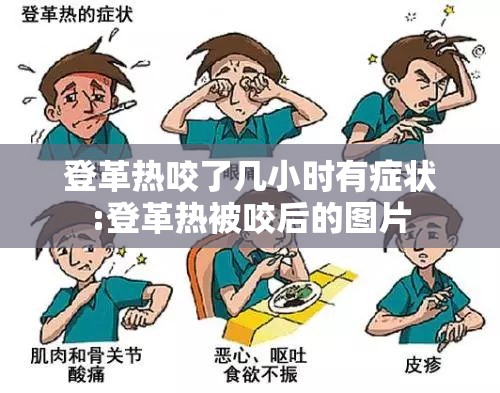 登革热咬了几小时有症状:登革热被咬后的图片