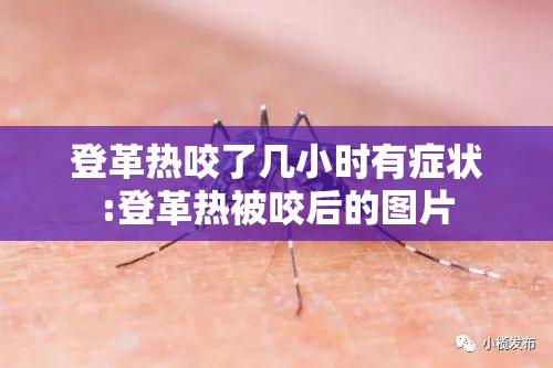 登革热咬了几小时有症状:登革热被咬后的图片