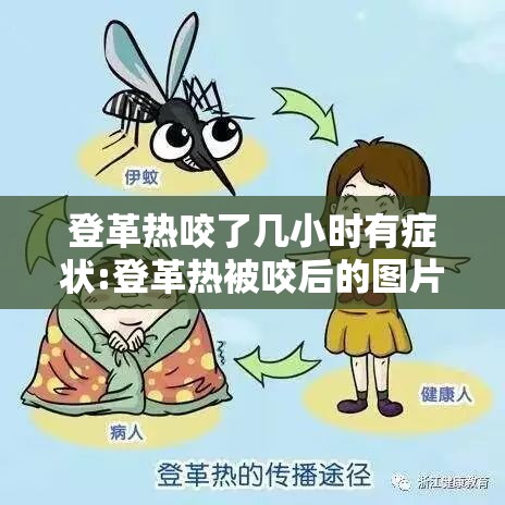 登革热咬了几小时有症状:登革热被咬后的图片
