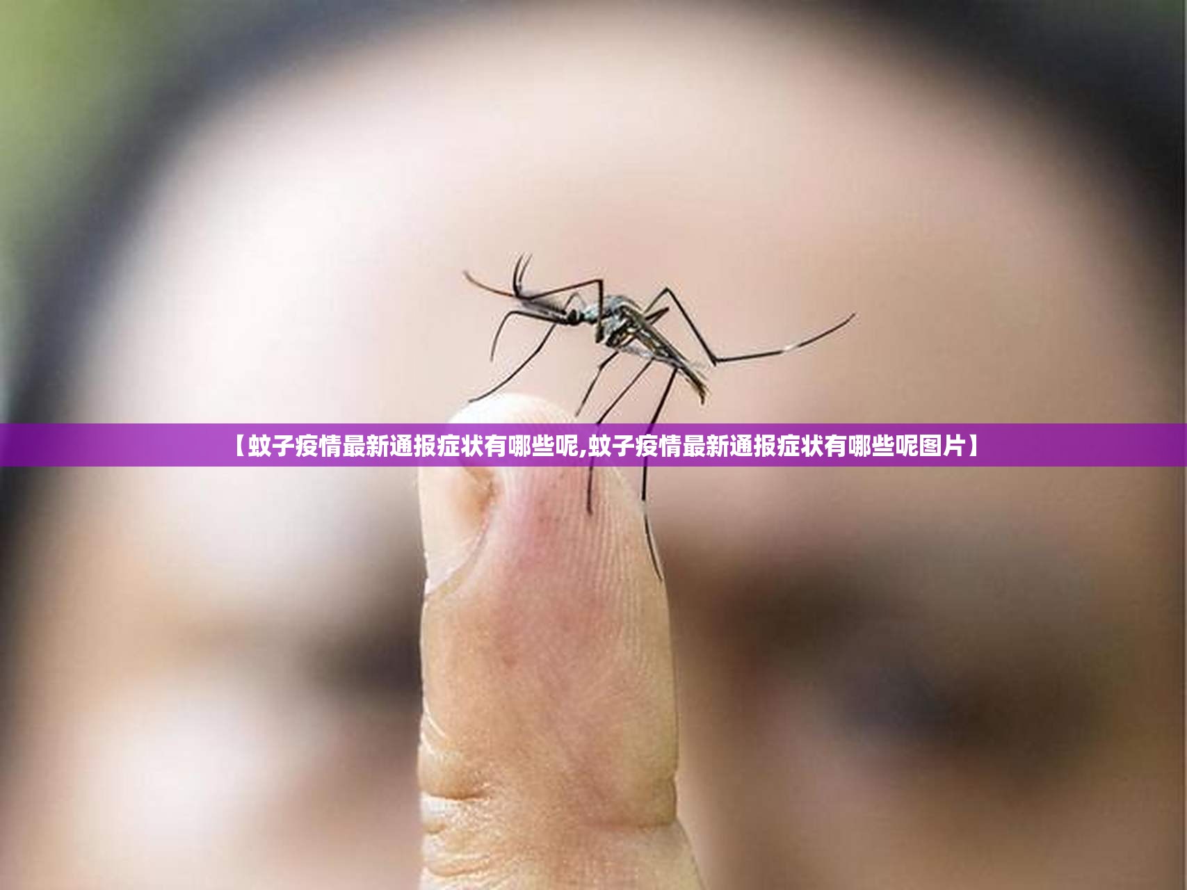 【蚊子疫情最新通报症状有哪些呢,蚊子疫情最新通报症状有哪些呢图片】