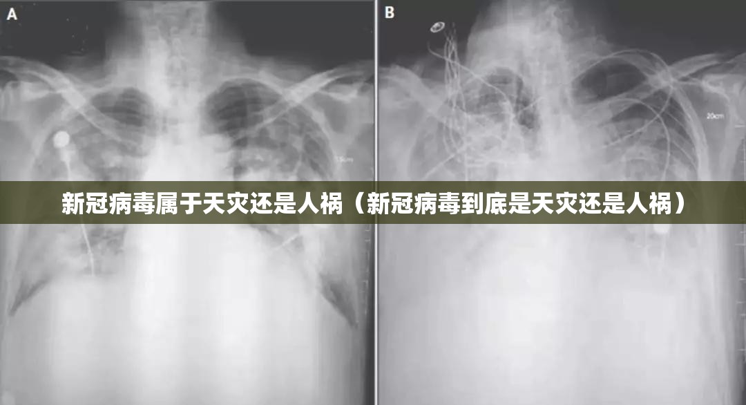 新冠病毒属于天灾还是人祸（新冠病毒到底是天灾还是人祸）