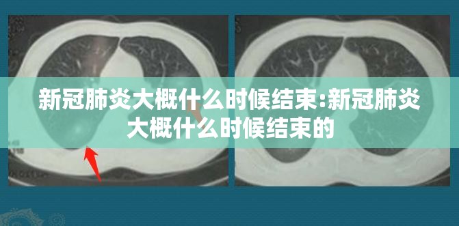 新冠肺炎大概什么时候结束:新冠肺炎大概什么时候结束的
