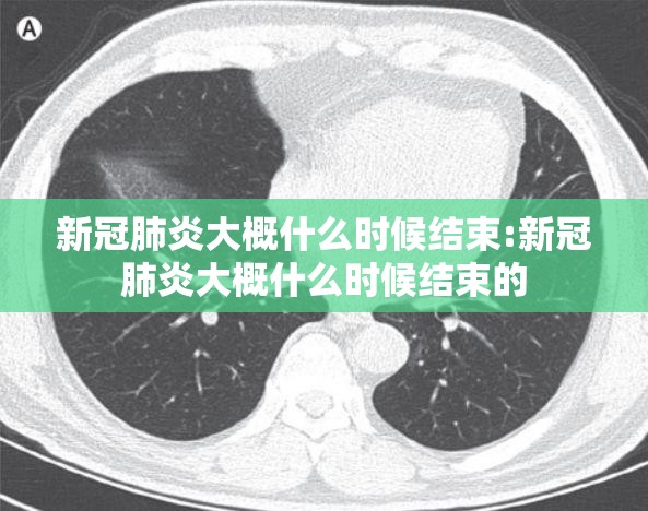新冠肺炎大概什么时候结束:新冠肺炎大概什么时候结束的