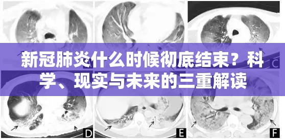 新冠肺炎什么时候彻底结束？科学、现实与未来的三重解读