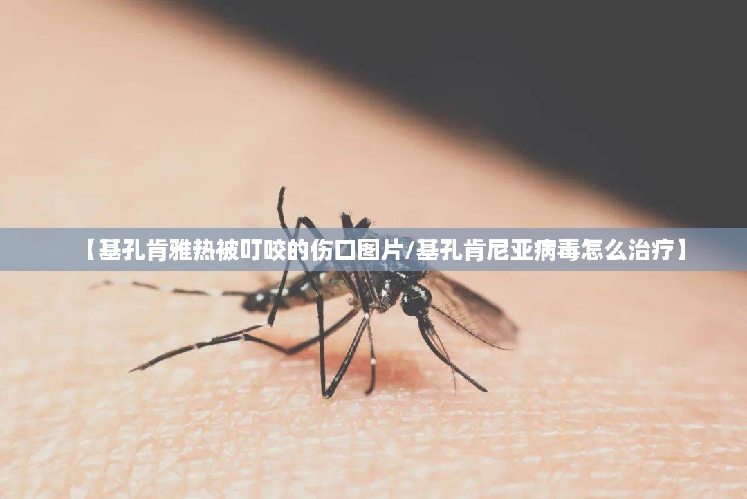 【基孔肯雅热被叮咬的伤口图片/基孔肯尼亚病毒怎么治疗】