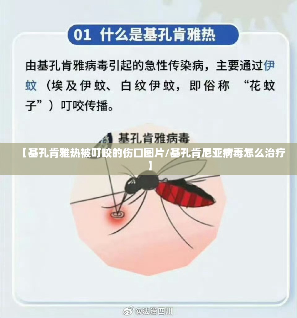 【基孔肯雅热被叮咬的伤口图片/基孔肯尼亚病毒怎么治疗】
