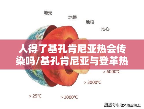 人得了基孔肯尼亚热会传染吗/基孔肯尼亚与登革热