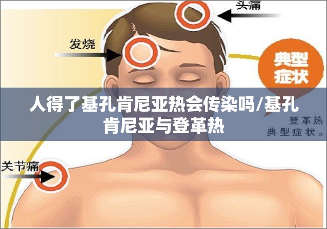 人得了基孔肯尼亚热会传染吗/基孔肯尼亚与登革热