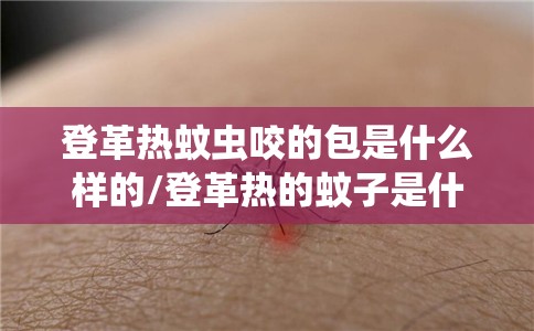 登革热蚊虫咬的包是什么样的/登革热的蚊子是什么意思