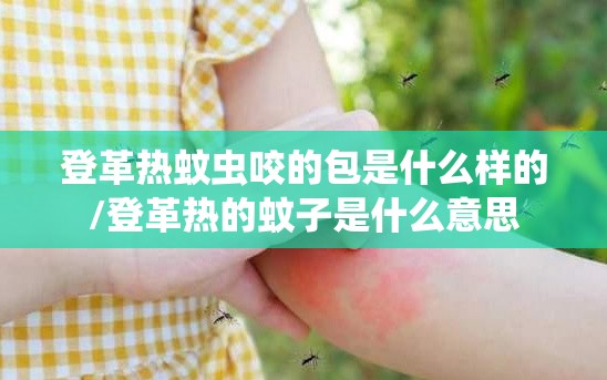 登革热蚊虫咬的包是什么样的/登革热的蚊子是什么意思