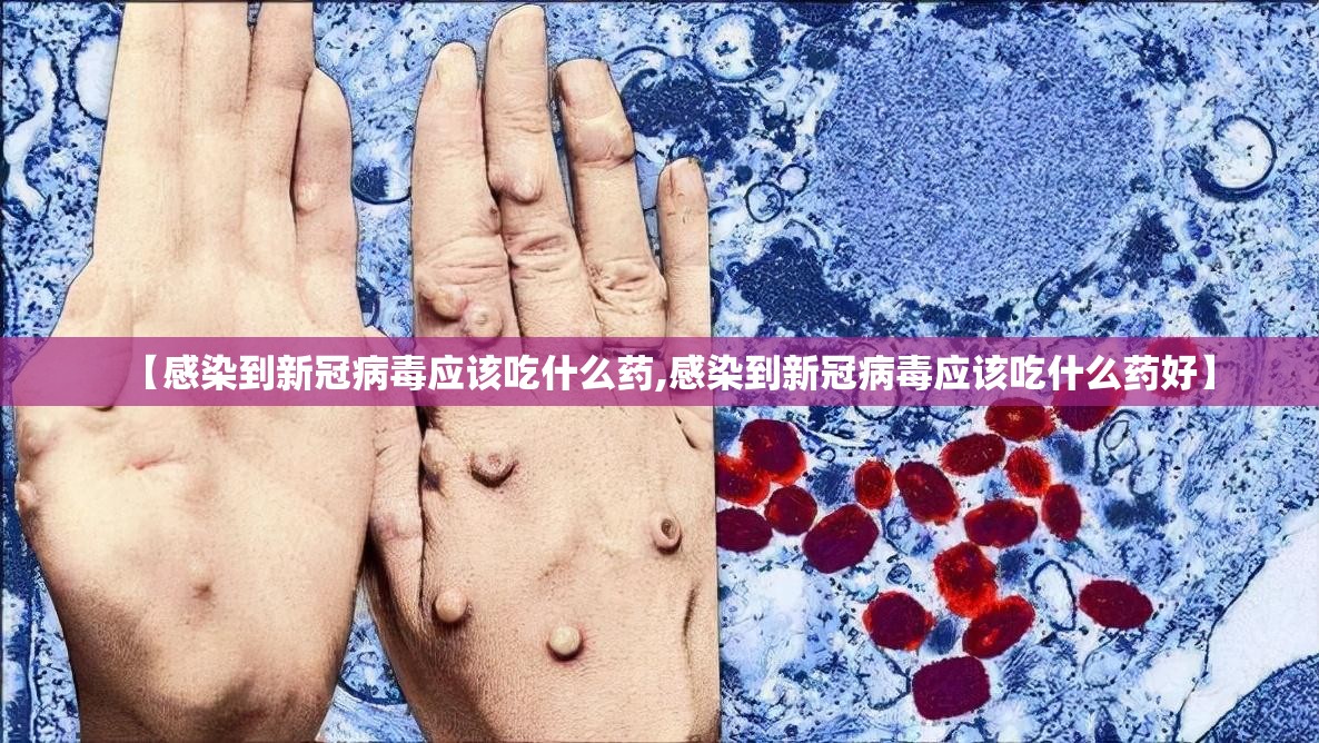 【感染到新冠病毒应该吃什么药,感染到新冠病毒应该吃什么药好】