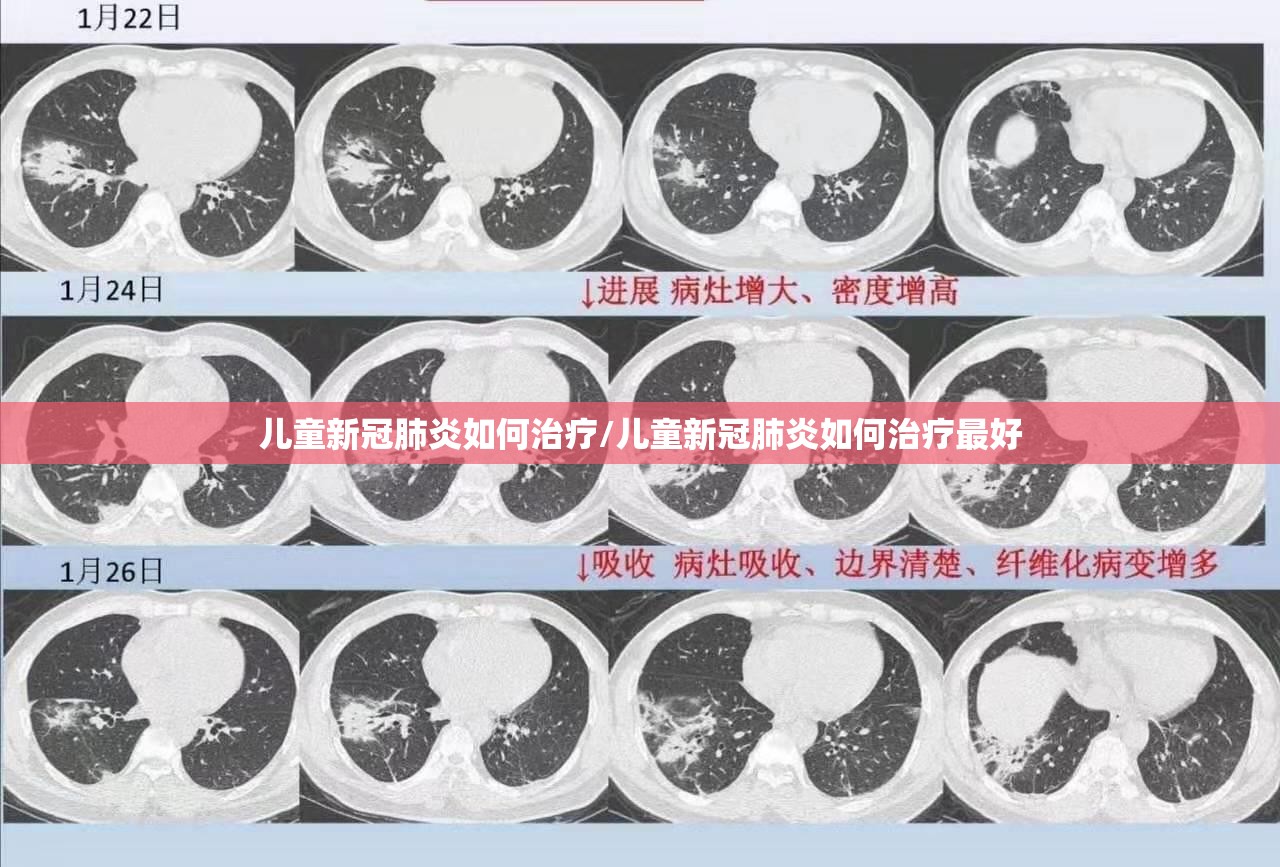 儿童新冠肺炎如何治疗/儿童新冠肺炎如何治疗最好