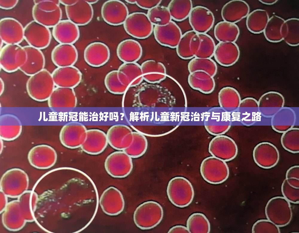 儿童新冠能治好吗？解析儿童新冠治疗与康复之路