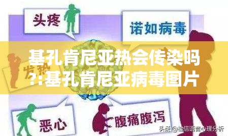 基孔肯尼亚热会传染吗?:基孔肯尼亚病毒图片