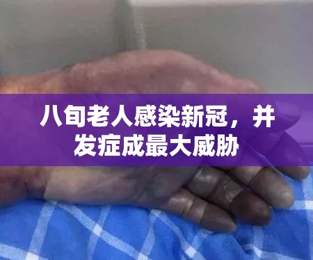八旬老人感染新冠，并发症成最大威胁