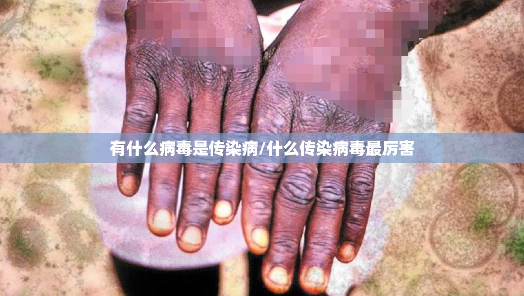 有什么病毒是传染病/什么传染病毒最厉害