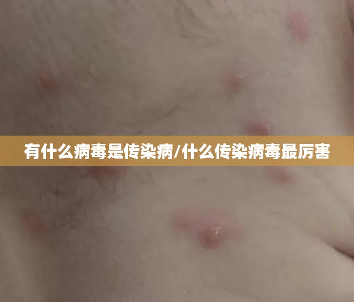 有什么病毒是传染病/什么传染病毒最厉害