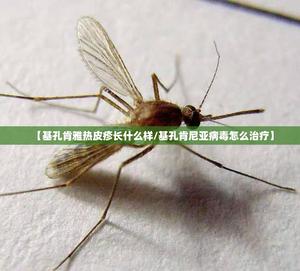 【基孔肯雅热皮疹长什么样/基孔肯尼亚病毒怎么治疗】