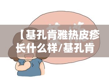 【基孔肯雅热皮疹长什么样/基孔肯尼亚病毒怎么治疗】