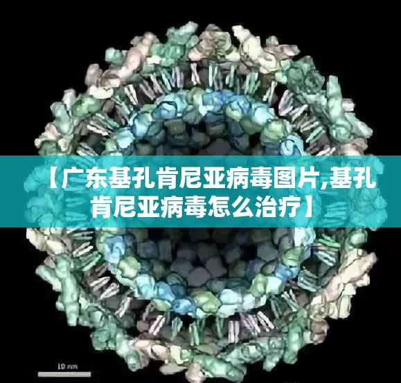 【广东基孔肯尼亚病毒图片,基孔肯尼亚病毒怎么治疗】
