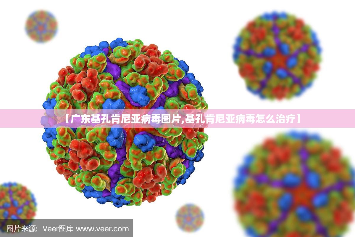 【广东基孔肯尼亚病毒图片,基孔肯尼亚病毒怎么治疗】
