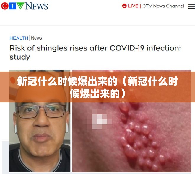 新冠什么时候爆出来的（新冠什么时候爆出来的）