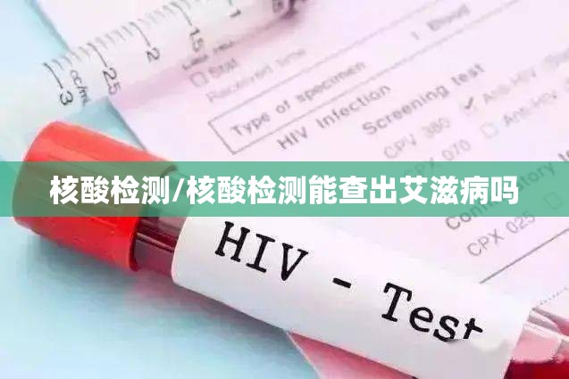 核酸检测/核酸检测能查出艾滋病吗