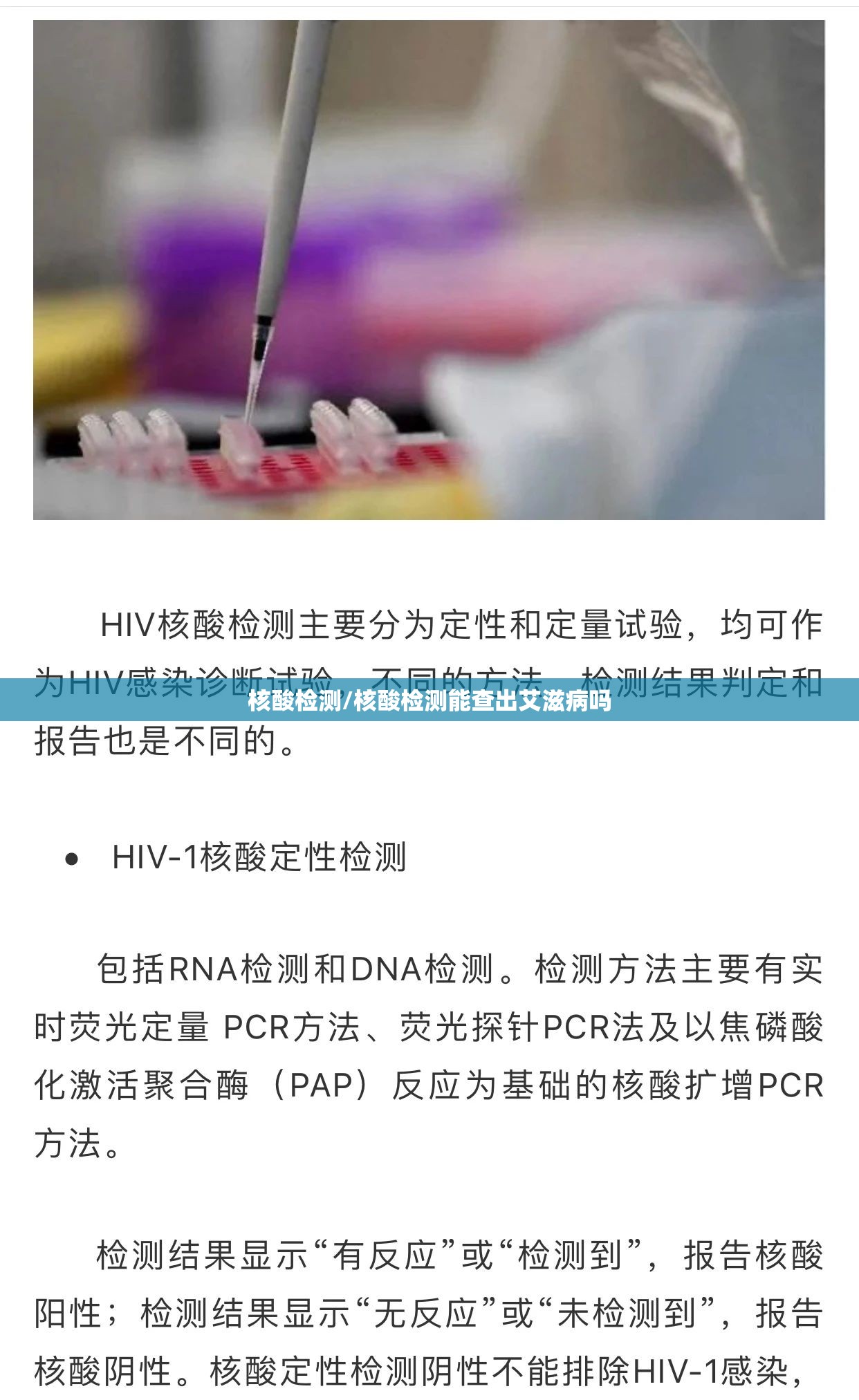 核酸检测/核酸检测能查出艾滋病吗
