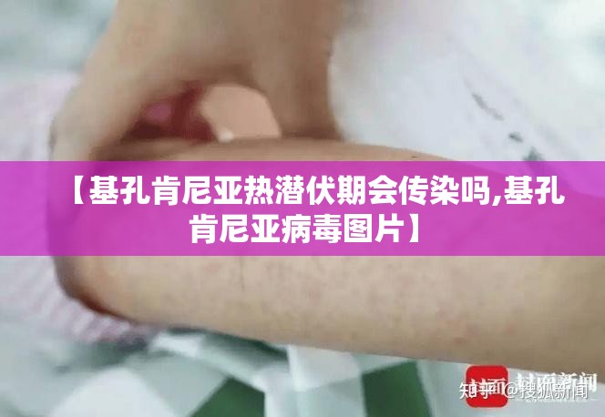 【基孔肯尼亚热潜伏期会传染吗,基孔肯尼亚病毒图片】