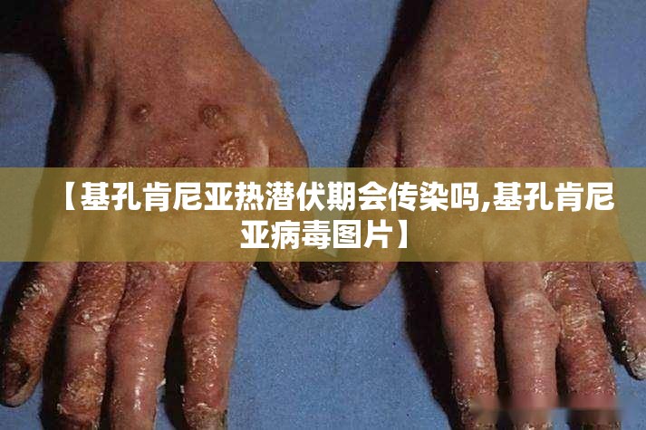 【广东蚊子是什么蚊子/广东蚊子真多】