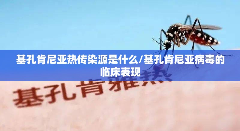 基孔肯尼亚热传染源是什么/基孔肯尼亚病毒的临床表现
