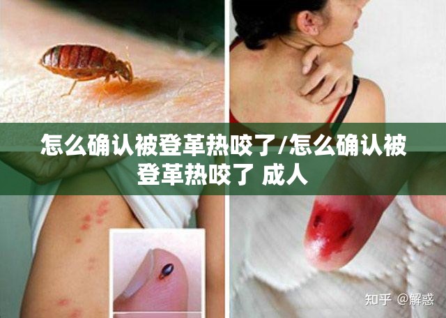 怎么确认被登革热咬了/怎么确认被登革热咬了 成人