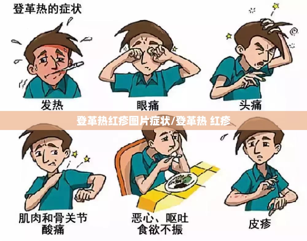 登革热红疹图片症状/登革热 红疹