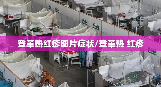登革热红疹图片症状/登革热 红疹