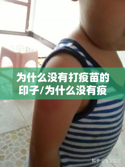 为什么没有打疫苗的印子/为什么没有疫苗打了