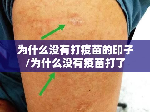 为什么没有打疫苗的印子/为什么没有疫苗打了