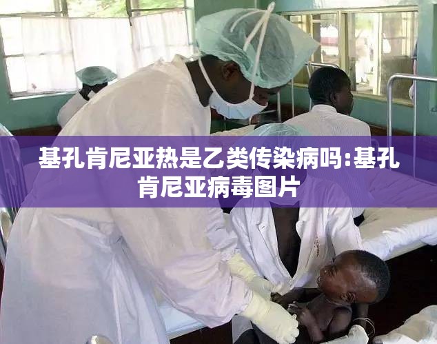 基孔肯尼亚热是乙类传染病吗:基孔肯尼亚病毒图片