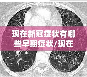 现在新冠症状有哪些早期症状/现在新冠新症状