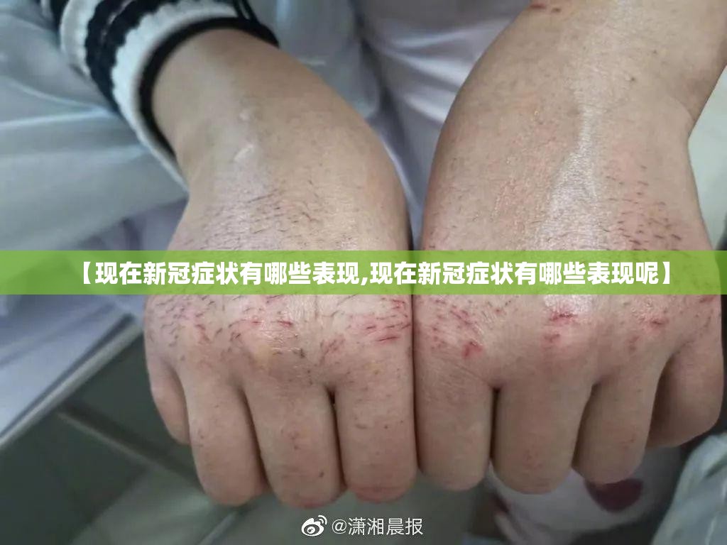 【现在新冠症状有哪些表现,现在新冠症状有哪些表现呢】
