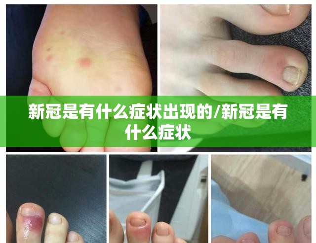 新冠是有什么症状出现的/新冠是有什么症状 新冠是有什么症状出现的/新冠是有什么症状