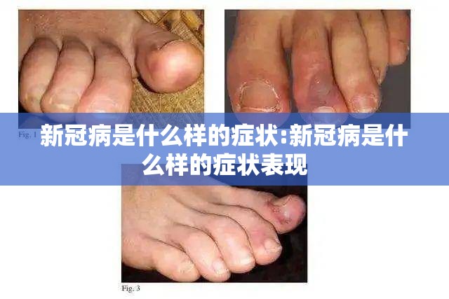 新冠病是什么样的症状:新冠病是什么样的症状表现